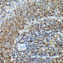 Anti-PI3 kinase p110 gamma antibody used in IHC (Paraffin sections) (IHC-P). GTX04094