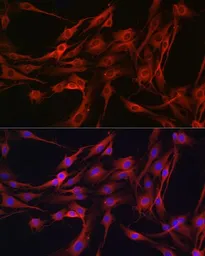 Anti-PI3 kinase p110 gamma antibody used in Immunocytochemistry/ Immunofluorescence (ICC/IF). GTX04094