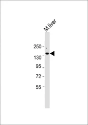 Anti-ATP7b antibody used in Western Blot (WB). GTX04095