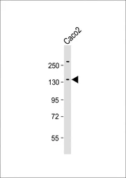 Anti-ATP7b antibody used in Western Blot (WB). GTX04095