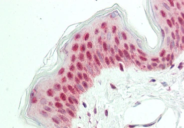 Anti-POU2F3 antibody used in IHC (Paraffin sections) (IHC-P). GTX04103