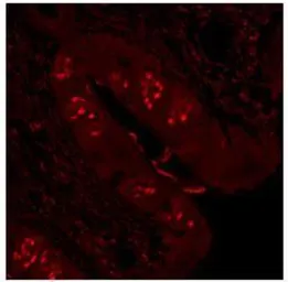 Anti-POU2F3 antibody used in Immunohistochemistry (IHC). GTX04103