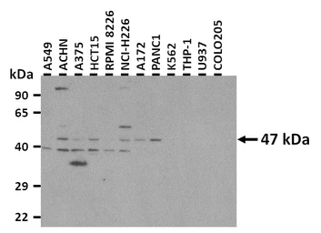 Anti-POU2F3 antibody used in Western Blot (WB). GTX04103