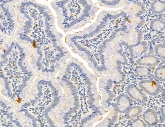 Anti-CCR2 antibody used in IHC (Paraffin sections) (IHC-P). GTX04115