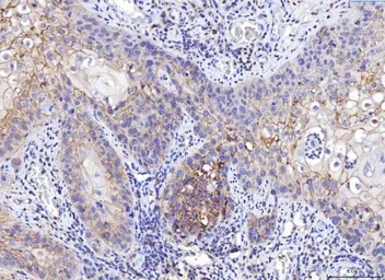 Anti-CD155 antibody [5I13D1] used in IHC (Paraffin sections) (IHC-P). GTX04249
