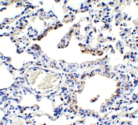 Anti-NCOA4 antibody used in IHC (Paraffin sections) (IHC-P). GTX04250