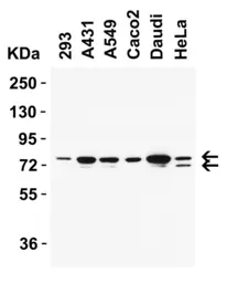 Anti-NCOA4 antibody used in Western Blot (WB). GTX04250