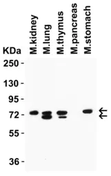 Anti-NCOA4 antibody used in Western Blot (WB). GTX04250