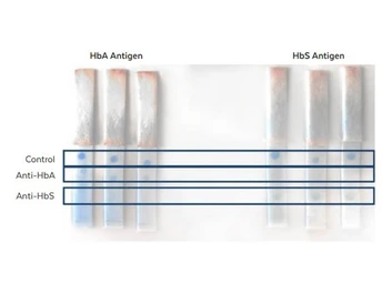 Anti-Hemoglobin beta antibody [14G2.G11.F11] used in Lateral Flow (Lateral Flow). GTX04267