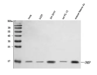 Anti-OMP antibody used in Western Blot (WB). GTX04312