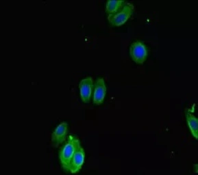 Anti-SMOC1 antibody used in Immunocytochemistry/ Immunofluorescence (ICC/IF). GTX04320