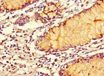 Anti-SMOC1 antibody used in IHC (Paraffin sections) (IHC-P). GTX04320