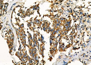 Anti-WNK3 antibody used in IHC (Paraffin sections) (IHC-P). GTX04322