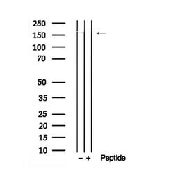 Anti-DEPDC5 (phospho Ser1002) antibody used in Western Blot (WB). GTX04327
