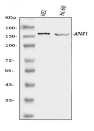 Anti-APAF1 antibody used in Western Blot (WB). GTX04330