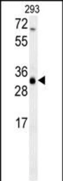 Anti-SC4MOL antibody used in Western Blot (WB). GTX04338
