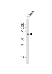 Anti-SHARP1 antibody used in Western Blot (WB). GTX04346