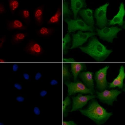 Anti-SHARP1 antibody used in Immunocytochemistry/ Immunofluorescence (ICC/IF). GTX04347