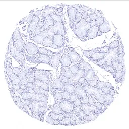 Anti-Mucin 5AC antibody [MSVA-109M] HistoMAX&trade; used in IHC (Paraffin sections) (IHC-P). GTX04364