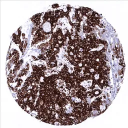 Anti-Mucin 5AC antibody [MSVA-109M] HistoMAX&trade; used in IHC (Paraffin sections) (IHC-P). GTX04364