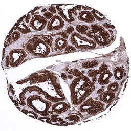Anti-Thyroglobulin antibody [MSVA-189R] HistoMAX&trade; used in IHC (Paraffin sections) (IHC-P). GTX04365