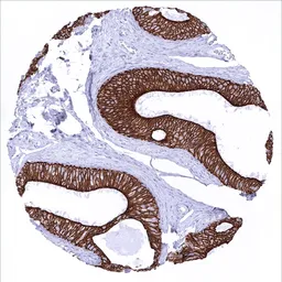 Anti-Cytokeratin 18 antibody [MSVA-118R] HistoMAX&trade; used in IHC (Paraffin sections) (IHC-P). GTX04374