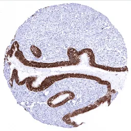 Anti-Cytokeratin 18 antibody [MSVA-118R] HistoMAX&trade; used in IHC (Paraffin sections) (IHC-P). GTX04374