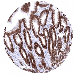 Anti-Cytokeratin 18 antibody [MSVA-118R] HistoMAX&trade; used in IHC (Paraffin sections) (IHC-P). GTX04374