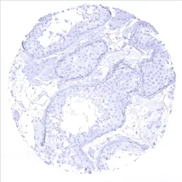 Anti-Cytokeratin 7 antibody [MSVA-607R] HistoMAX&trade; used in IHC (Paraffin sections) (IHC-P). GTX04375