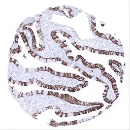 Anti-Cytokeratin 7 antibody [MSVA-607R] HistoMAX&trade; used in IHC (Paraffin sections) (IHC-P). GTX04375