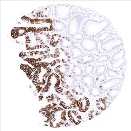 Anti-Cytokeratin 20 antibody [MSVA-620R] HistoMAX&trade; used in IHC (Paraffin sections) (IHC-P). GTX04376