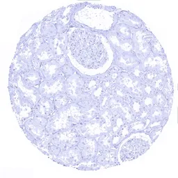 Anti-Melan A antibody [MSVA-900M] HistoMAX&trade; used in IHC (Paraffin sections) (IHC-P). GTX04383