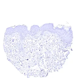 Anti-Cytokeratin 13 antibody [MSVA-613M] HistoMAX&trade; used in IHC (Paraffin sections) (IHC-P). GTX04385