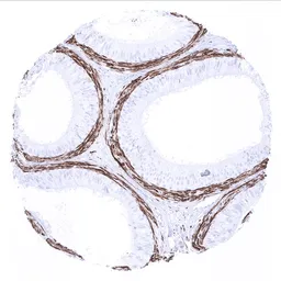 Anti-Calponin 1 antibody [MSVA-455R] HistoMAX&trade; used in IHC (Paraffin sections) (IHC-P). GTX04387
