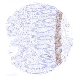 Anti-Calponin 1 antibody [MSVA-455R] HistoMAX&trade; used in IHC (Paraffin sections) (IHC-P). GTX04387