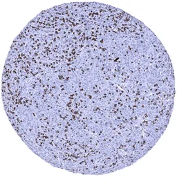 Anti-CD8 alpha antibody [MSVA-008R] HistoMAX&trade; used in IHC (Paraffin sections) (IHC-P). GTX04391