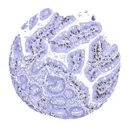 Anti-CD8 alpha antibody [MSVA-008R] HistoMAX&trade; used in IHC (Paraffin sections) (IHC-P). GTX04391