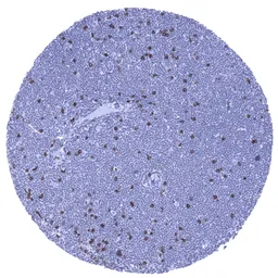 Anti-CD8 alpha antibody [MSVA-008R] HistoMAX&trade; used in IHC (Paraffin sections) (IHC-P). GTX04391