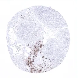 Anti-CD20 antibody [MSVA-020R] HistoMAX&trade; used in IHC (Paraffin sections) (IHC-P). GTX04392