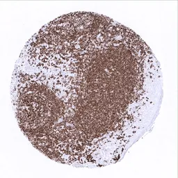 Anti-CD20 antibody [MSVA-020R] HistoMAX&trade; used in IHC (Paraffin sections) (IHC-P). GTX04392