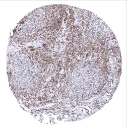 Anti-CD27 antibody [MSVA-027M] HistoMAX&trade; used in IHC (Paraffin sections) (IHC-P). GTX04394