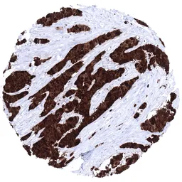 Anti-S100P antibody [MSVA-480R] HistoMAX&trade; used in IHC (Paraffin sections) (IHC-P). GTX04398