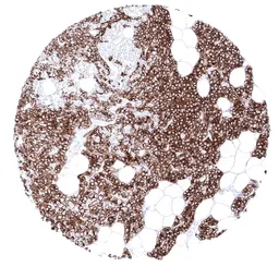 Anti-Parathyroid Hormone antibody [MSVA-525R] HistoMAX&trade; used in IHC (Paraffin sections) (IHC-P). GTX04405