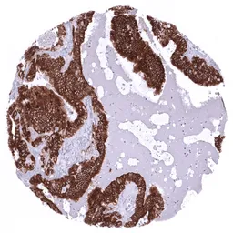 Anti-Mucin 6 antibody [MSVA-806R] HistoMAX&trade; used in IHC (Paraffin sections) (IHC-P). GTX04409