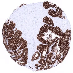 Anti-Mucin 6 antibody [MSVA-806R] HistoMAX&trade; used in IHC (Paraffin sections) (IHC-P). GTX04409