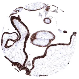 Anti-Inhibin alpha antibody [MSVA-561R] HistoMAX&trade; used in IHC (Paraffin sections) (IHC-P). GTX04415