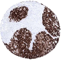 Anti-Inhibin alpha antibody [MSVA-561R] HistoMAX&trade; used in IHC (Paraffin sections) (IHC-P). GTX04415