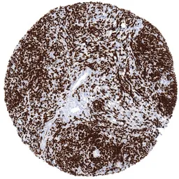 Anti-TdT antibody [MSVA-453R] HistoMAX&trade; used in IHC (Paraffin sections) (IHC-P). GTX04417