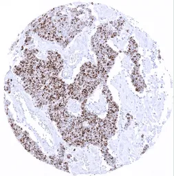 Anti-TdT antibody [MSVA-453R] HistoMAX&trade; used in IHC (Paraffin sections) (IHC-P). GTX04417
