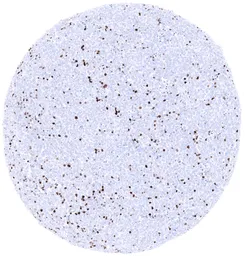 Anti-TdT antibody [MSVA-453R] HistoMAX&trade; used in IHC (Paraffin sections) (IHC-P). GTX04417